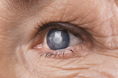 Eyes On You Family Eyecare   Optical | Dry Eye Treatment, Glaucoma Management and Diabetic Eye Exams